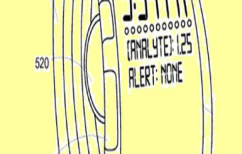 ΝΕΑ ΕΙΔΗΣΕΙΣ (H Google πατεντάρει βραχιόλι για την καταπολέμιση του καρκίνου)