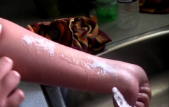 ΝΕΑ ΕΙΔΗΣΕΙΣ («Salt and Ice Challenge» – Η απειλητική μόδα για τα παιδιά από το Διαδίκτυο)