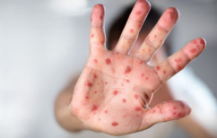 ΝΕΑ ΕΙΔΗΣΕΙΣ (Αύξηση των κρουσμάτων ιλαράς σε όλη την Ευρώπη-Ο ΠΟΥ απευθύνει έκκληση για εμβολιασμό)